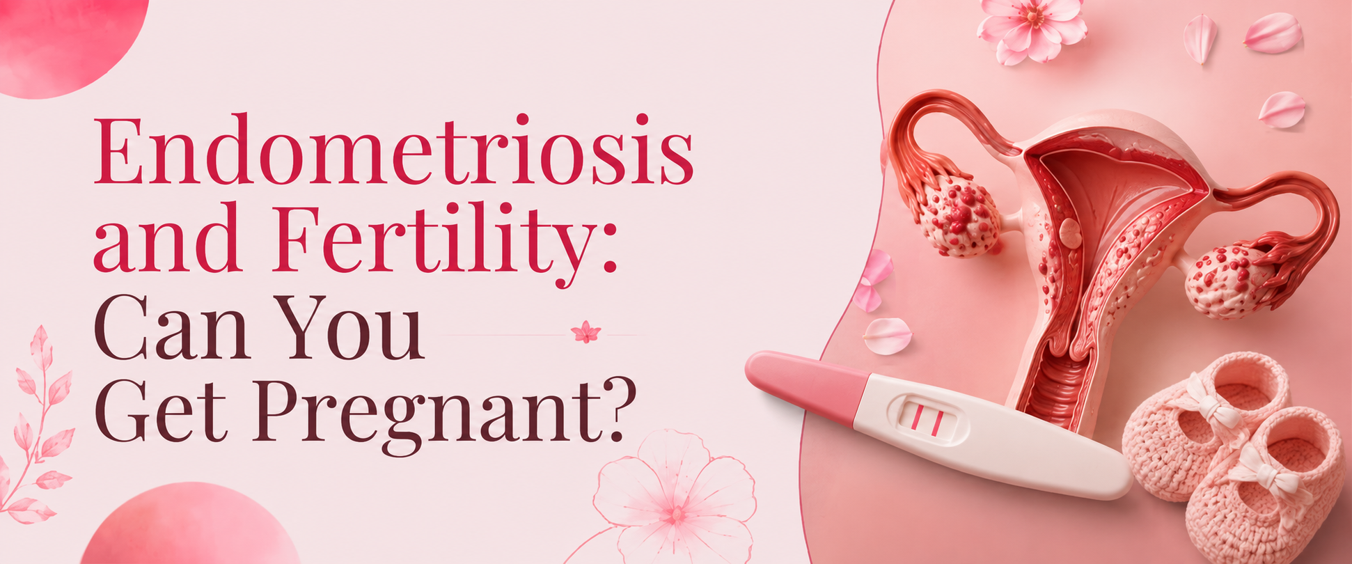 Endometriosis and Fertility: Can You Get Pregnant?