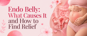 Endo Belly: What Causes It and How to Find Relief